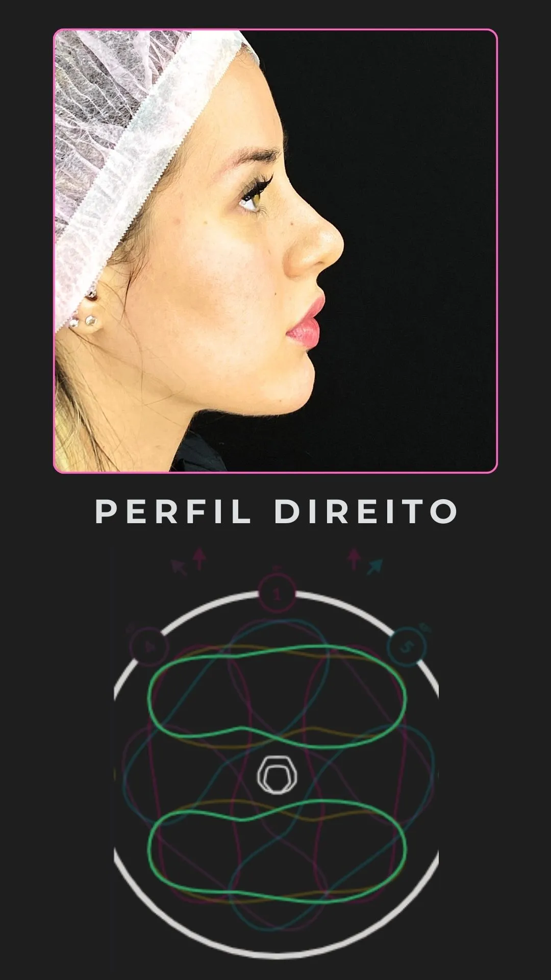 Perfil direito · o ângulo que mostra projeção