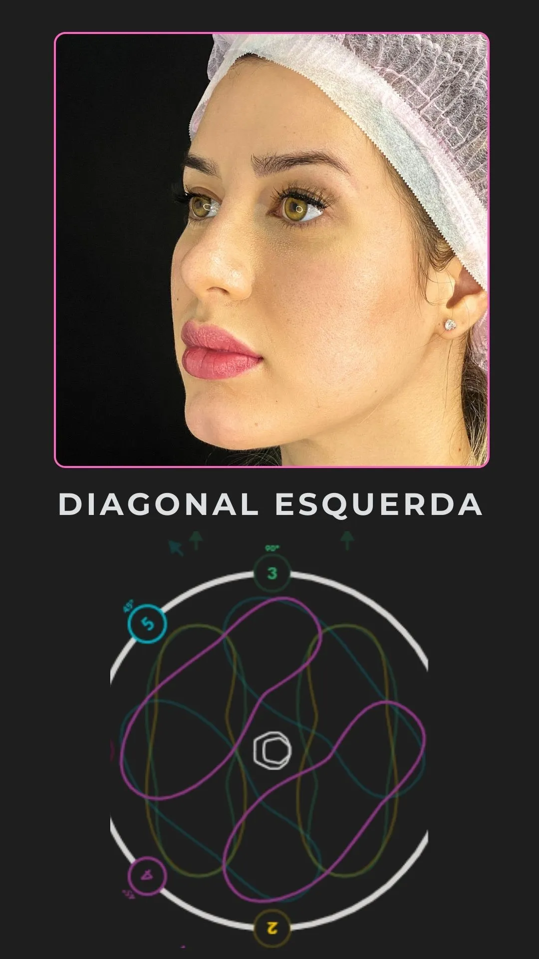 Diagonal esquerda · o corte que revela contorno